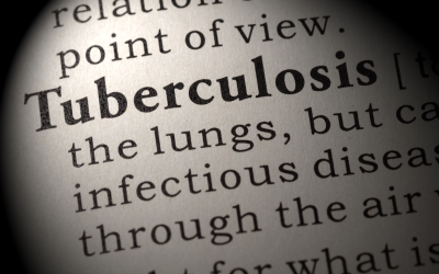Cara cegah tuberkolosis dengan hidup bersih dan sehat?