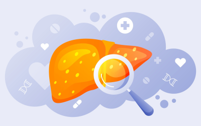 Punya Kolesterol Tinggi? Waspada Fatty Liver