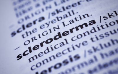 Kulit Mengeras dan Terasa Ketat? Ini Bisa Jadi Tanda Scleroderma Kulit